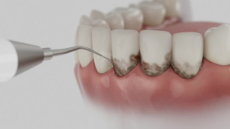 Reliable Wisdom Tooth Removal contractor in Habersham County County, GA by Dentist Open Now